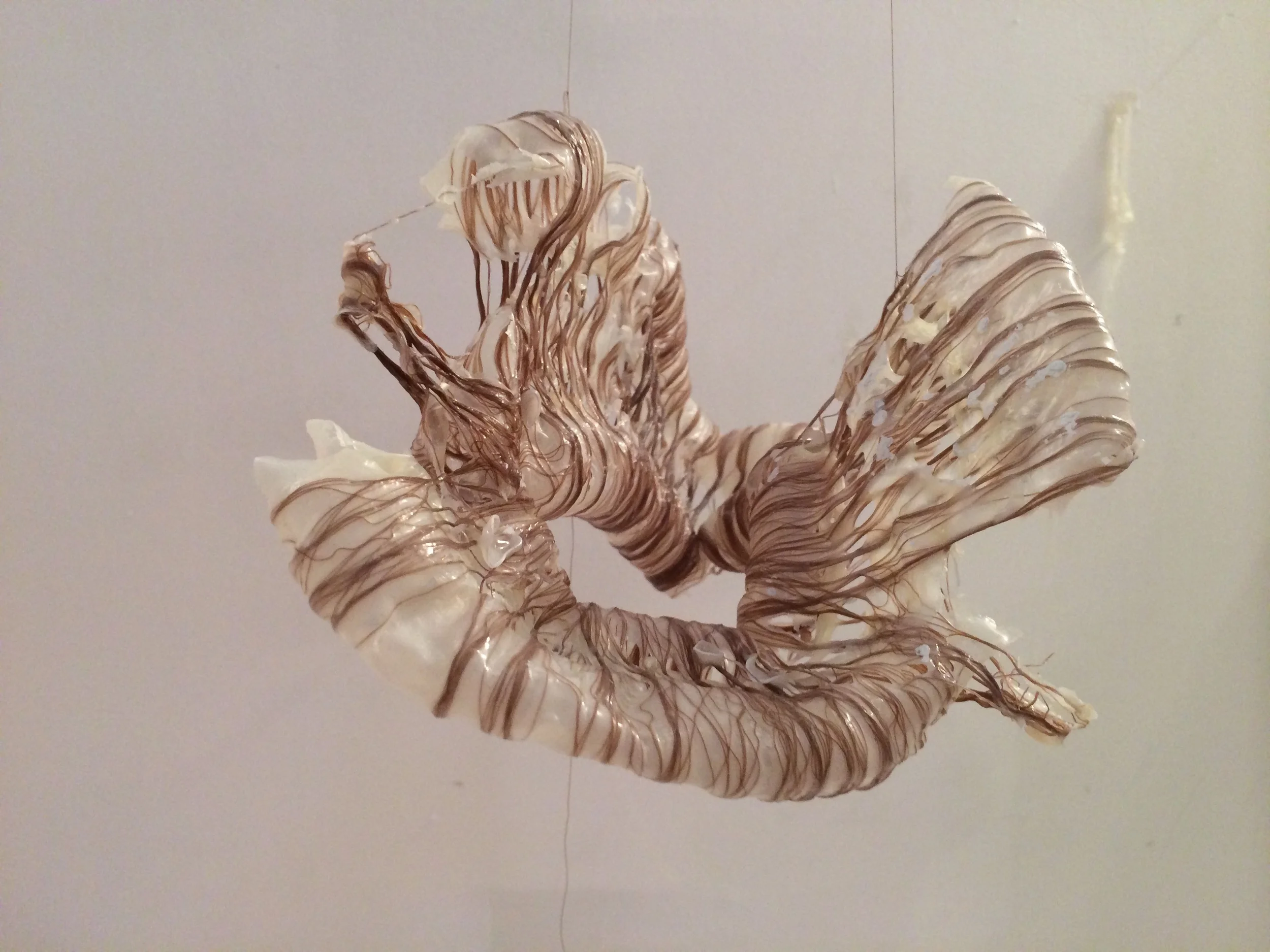 Retroperitoneal 1 (3).JPG