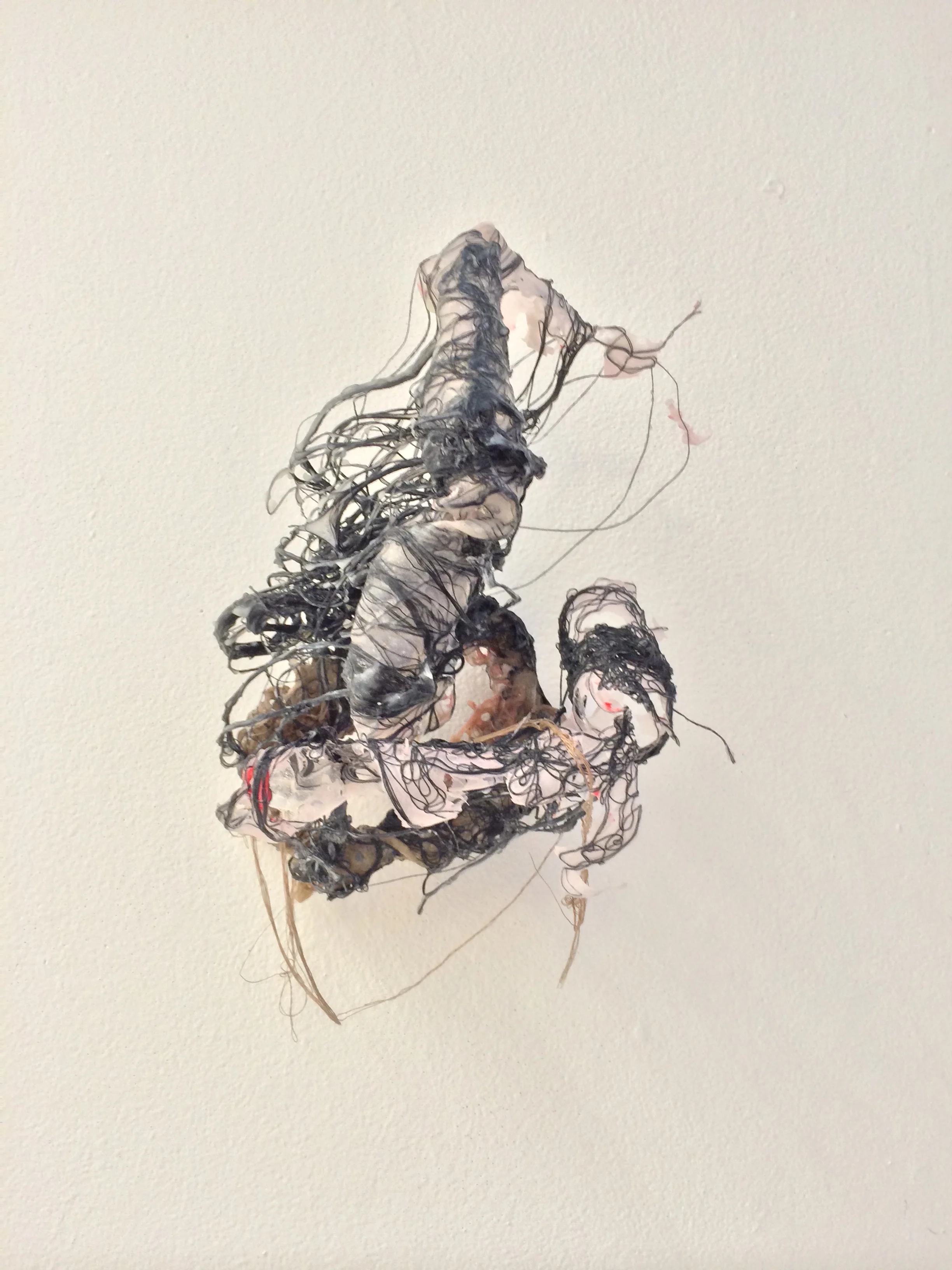 Retroperitoneal 2 (1).JPG