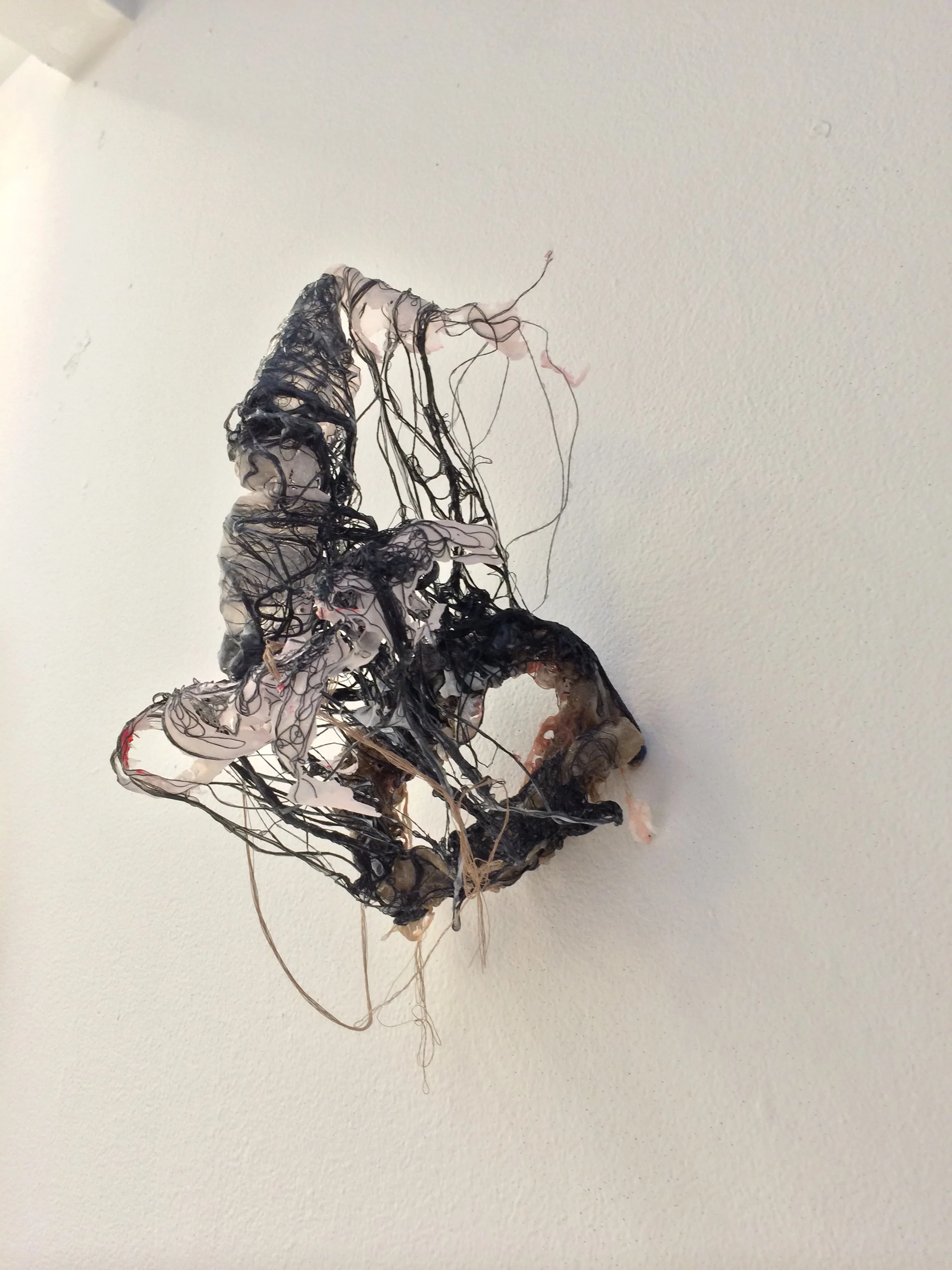 Retroperitoneal 2 (3).JPG