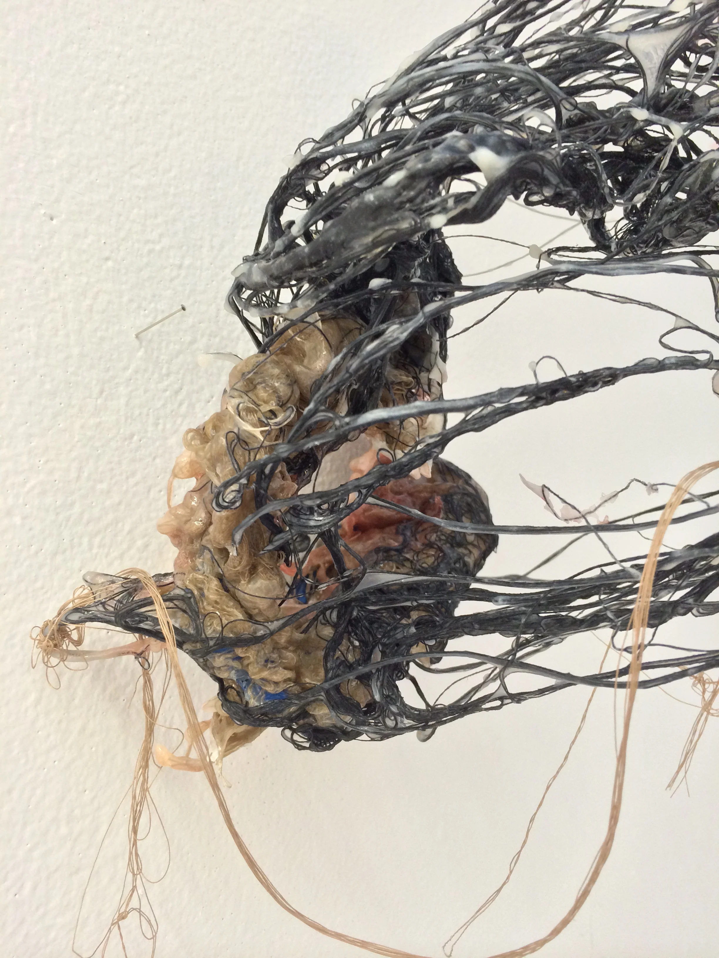 Retroperitoneal 2 (4).JPG