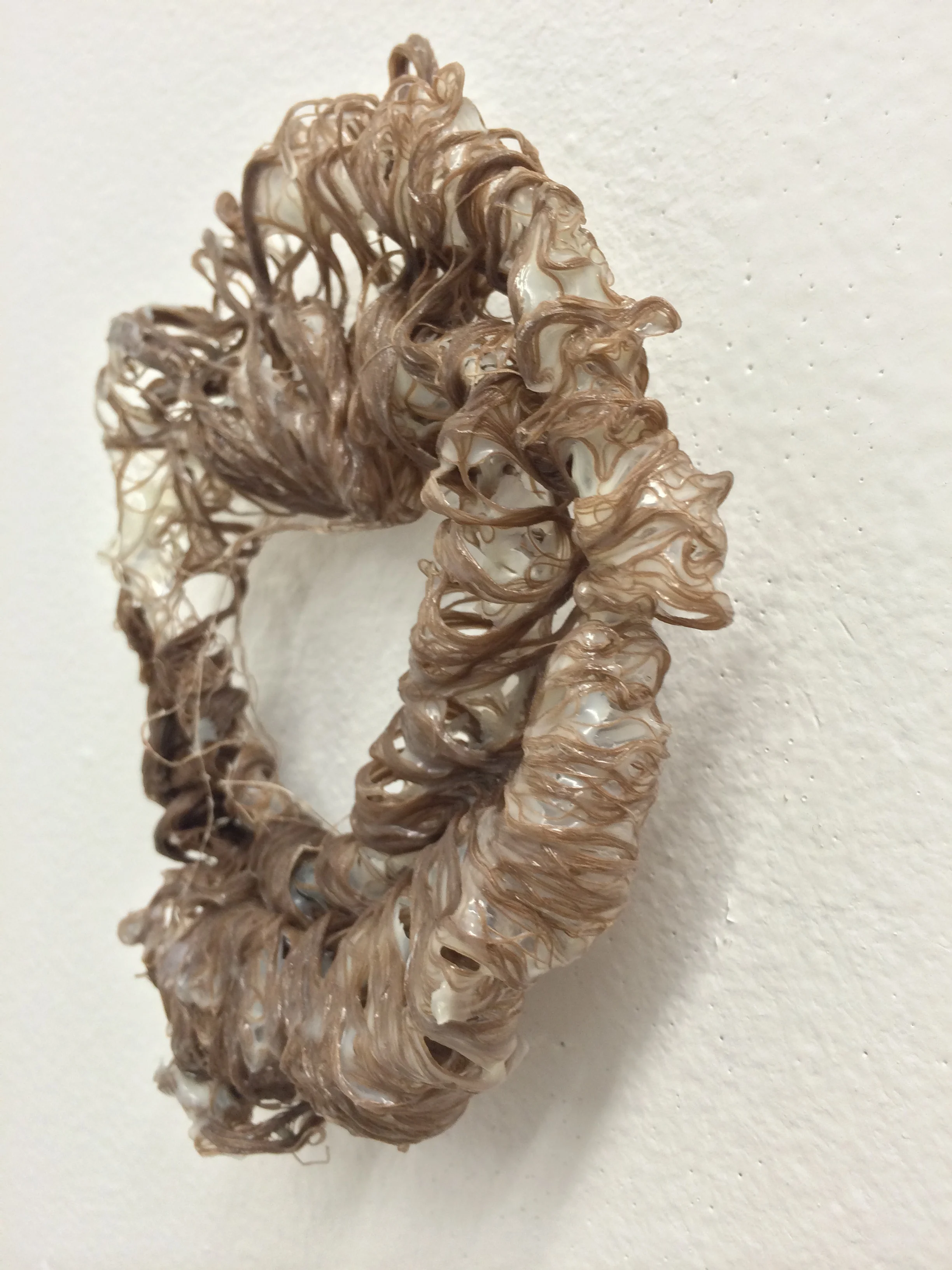 Retroperitoneal 4 (1).JPG