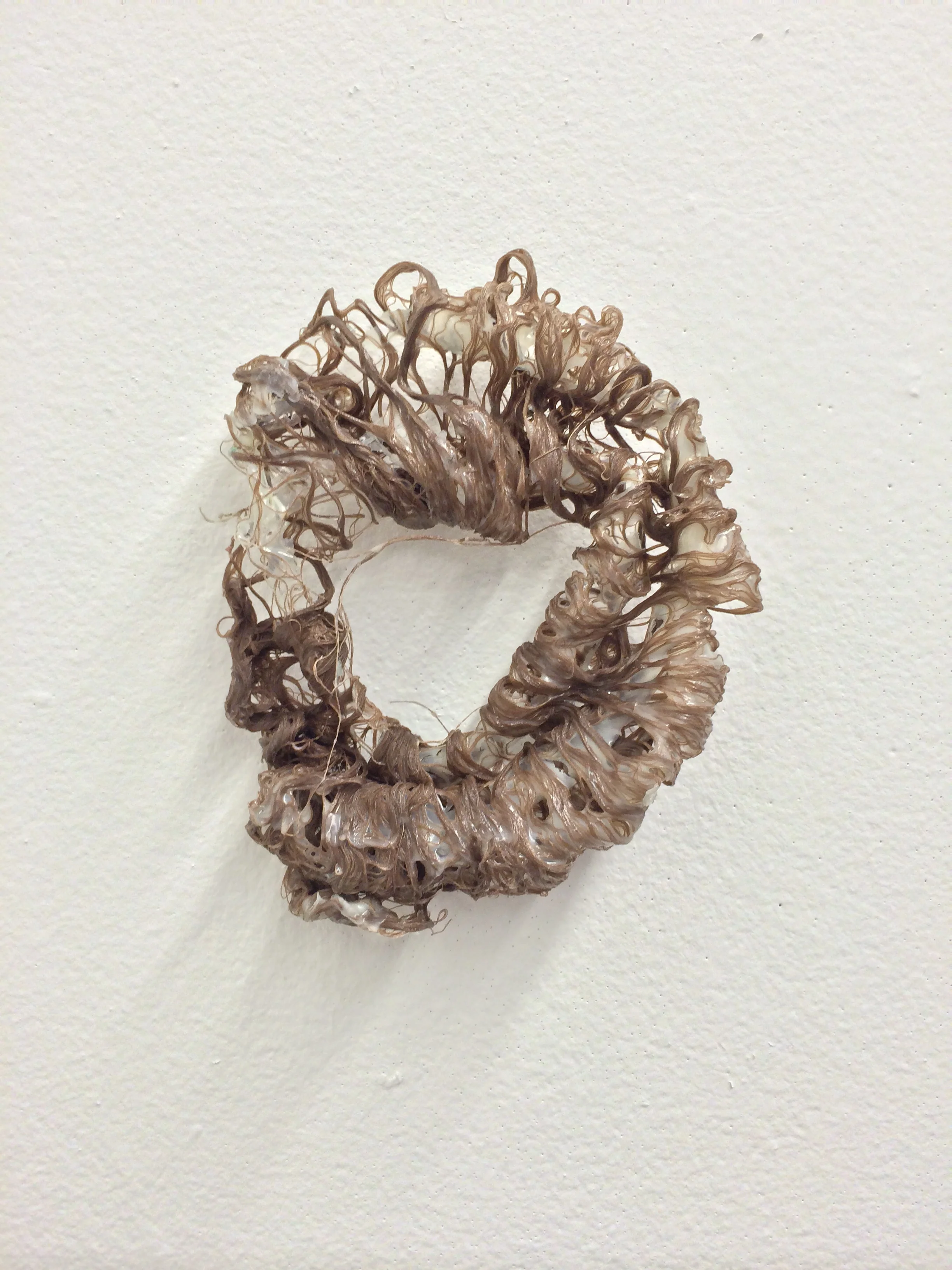 Retroperitoneal 4 (2).JPG