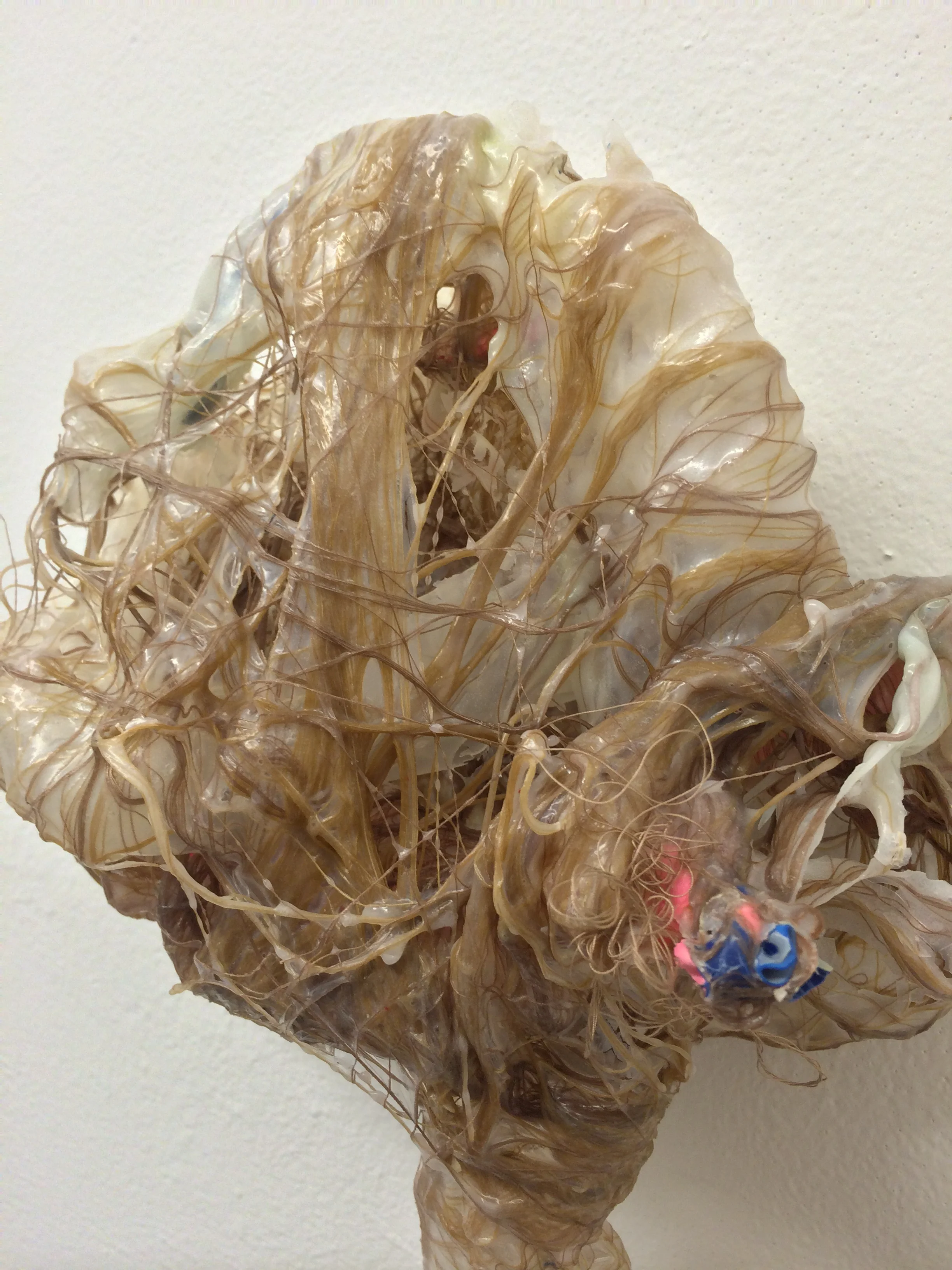 Retroperitoneal 5 (3).JPG