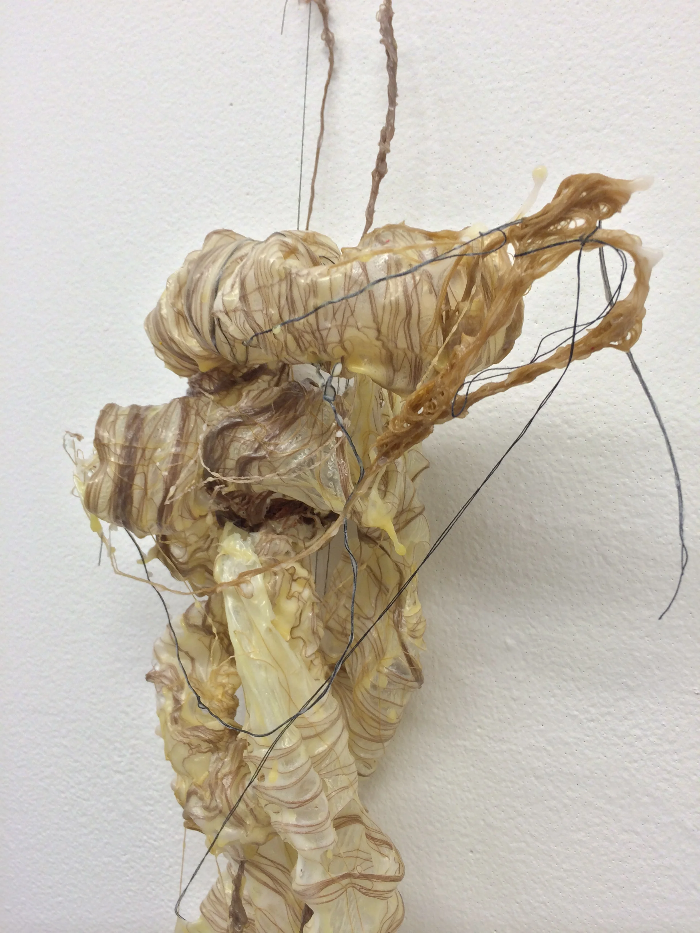 Retroperitoneal 6 (2).JPG