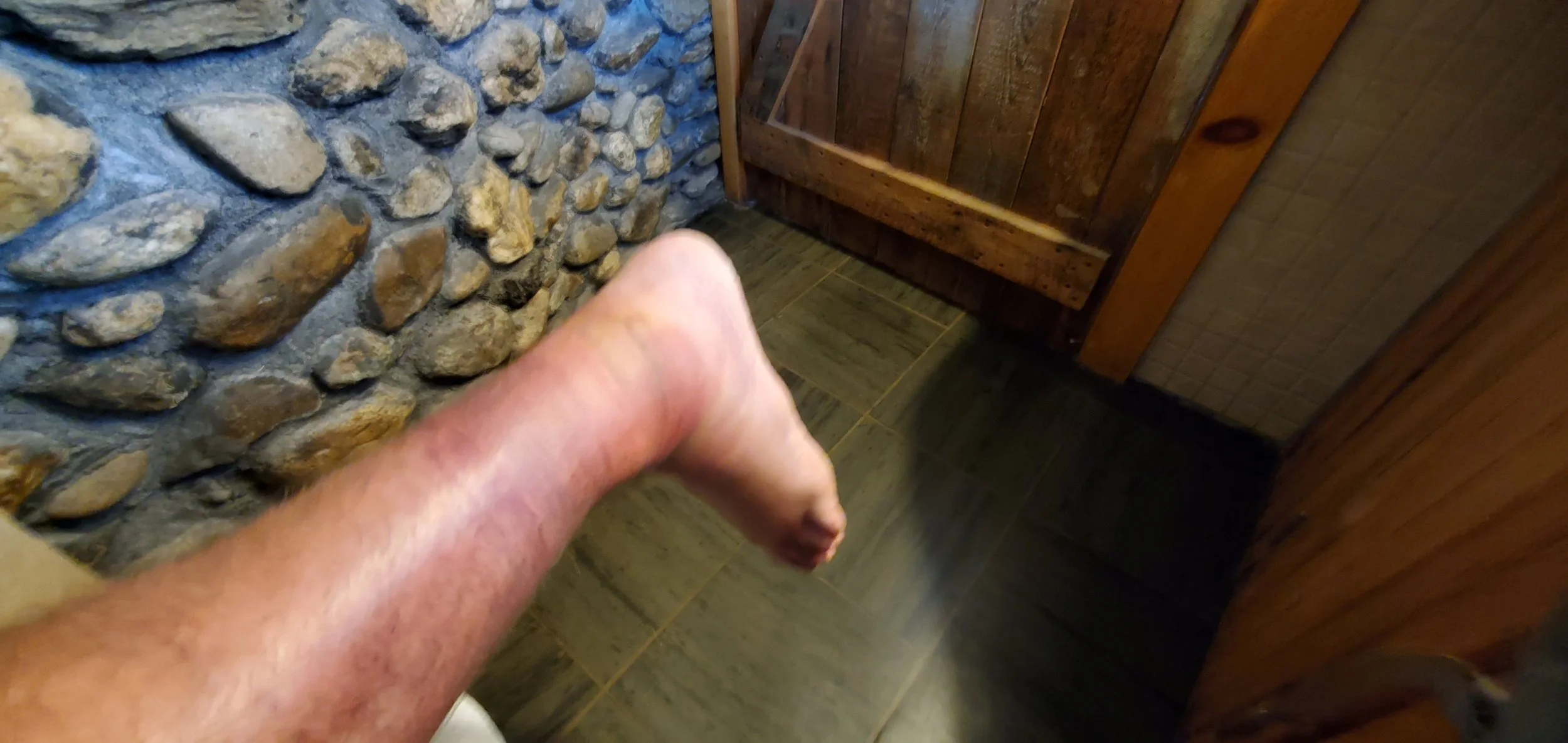 Here’s what the ankle looked like later on. Yeah… it was pretty haggard.