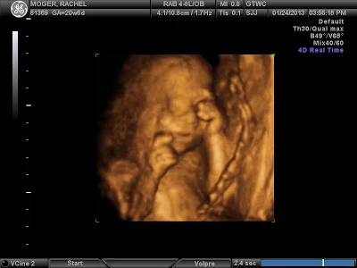 babymo.jpg