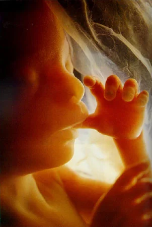 Day 5... “A Complete Turnaround”