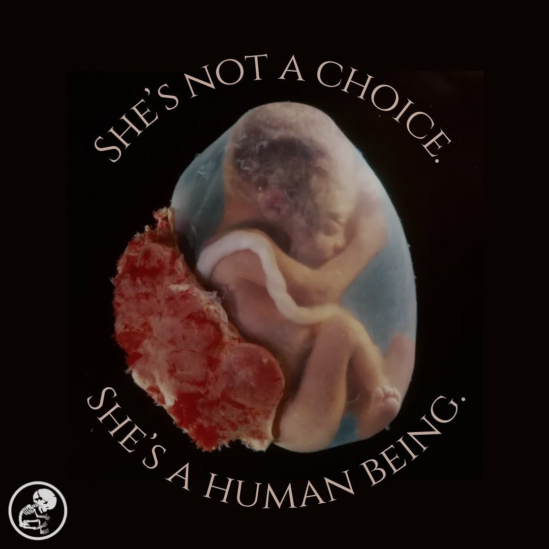 Taking the life of a baby in the womb should never be a choice.