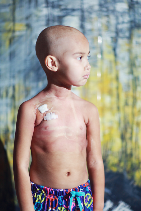 In September Desiray had her surgery to install a port in her chest. This replaced the picc line in her arm. It is supposed to make things easier however it would be months and months before the port started to work properly every time. 