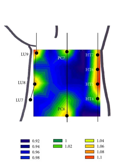 CT X-ray of acupuncture points