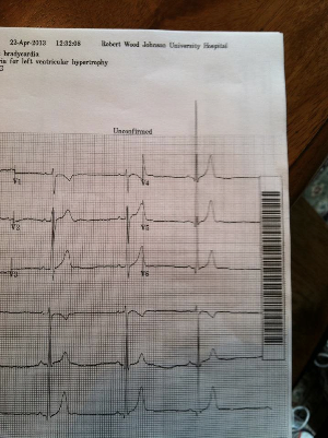 EKG - MAY 3.jpg