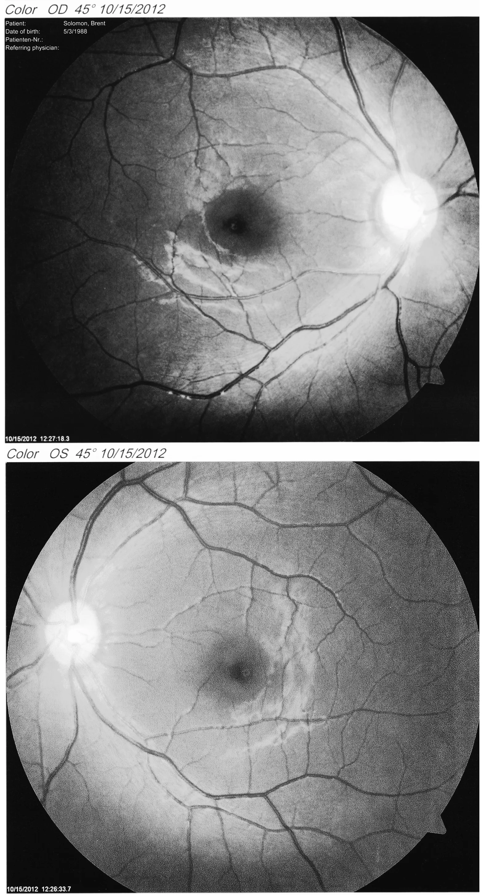 Closeup photographs of my eyes. 2012