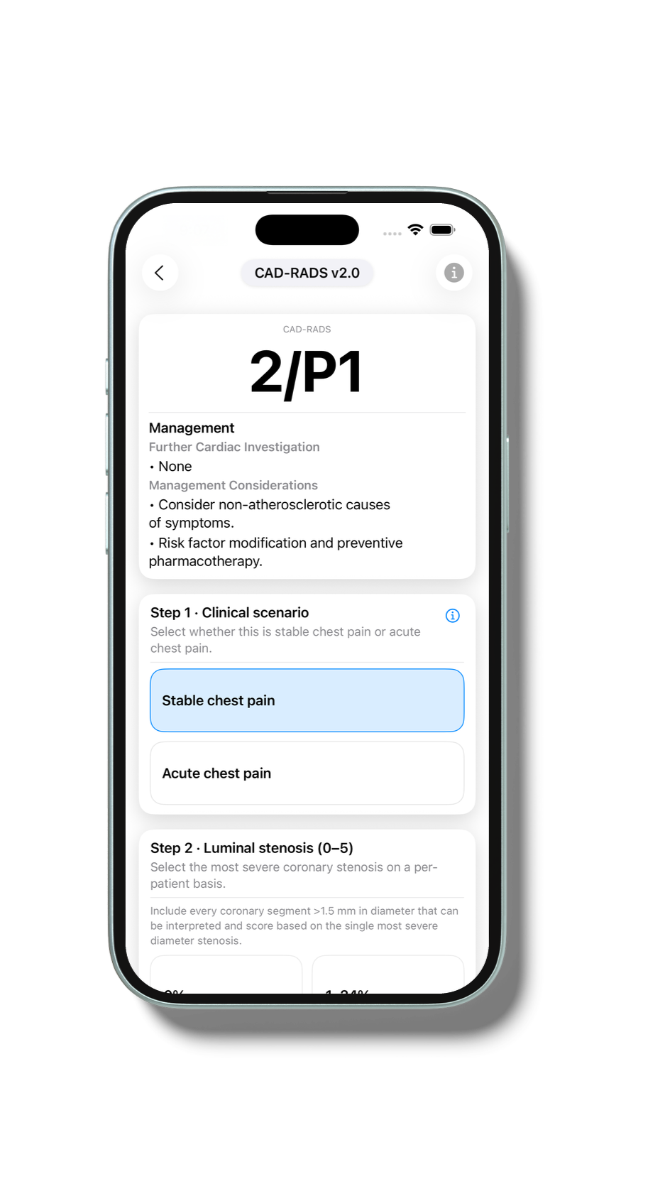 0x0ss-11_iphone_mockup.png