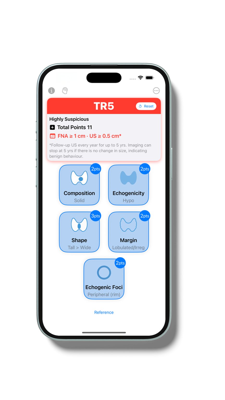 400x800bb-4_iphone_mockup.png