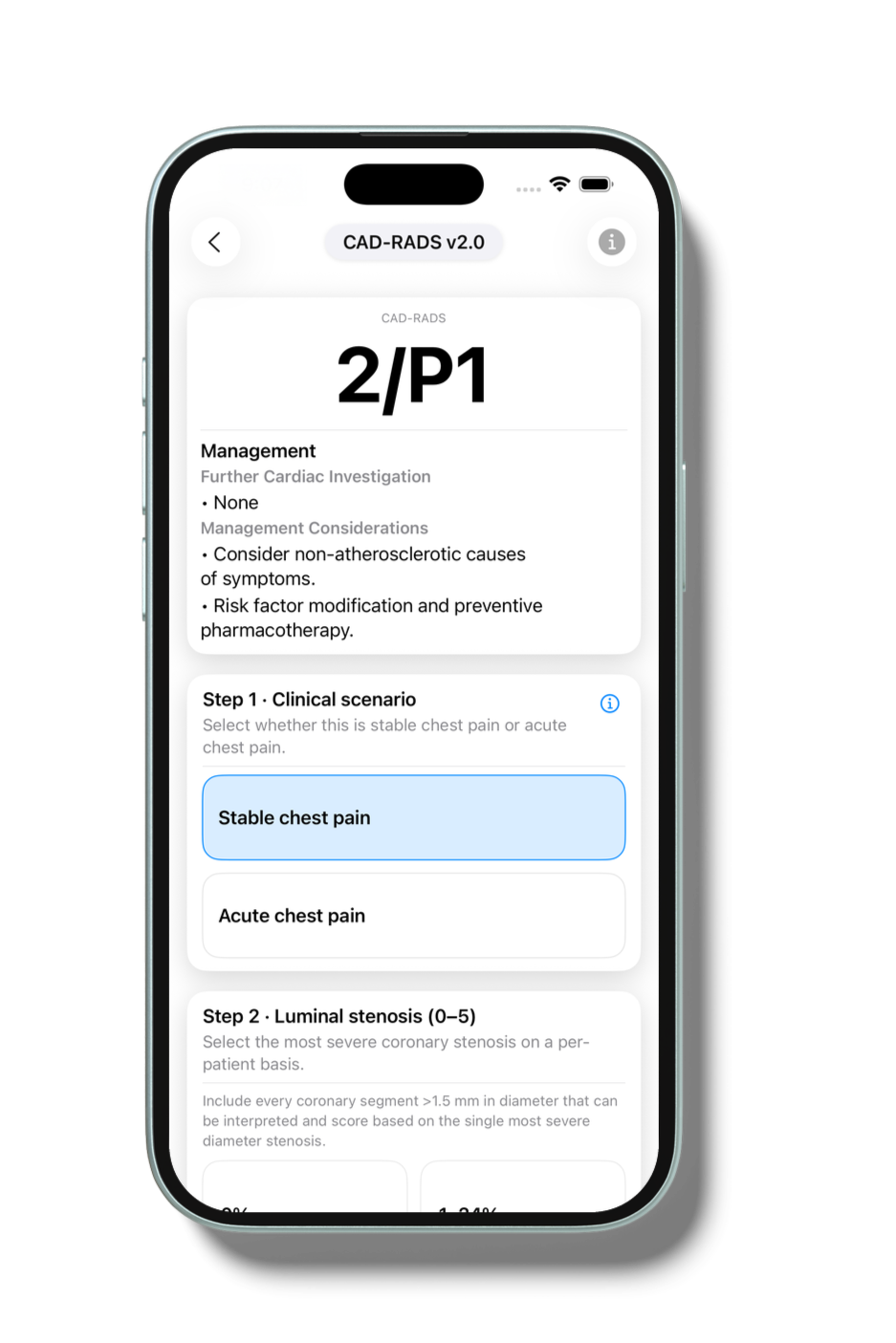 0x0ss-11_iphone_mockup.png