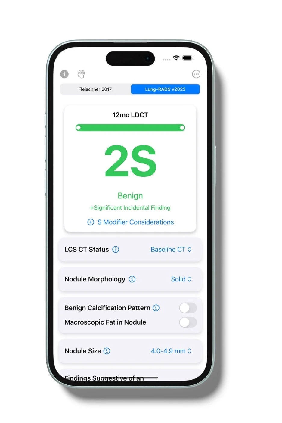 iphone+LNG+LR+S+score+LM.png