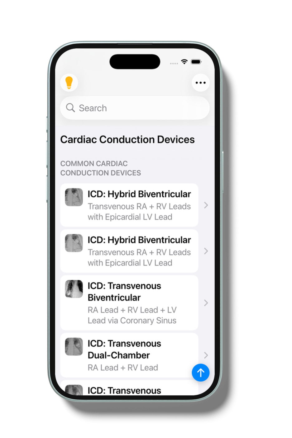 400x800bb-19_iphone_mockup.png