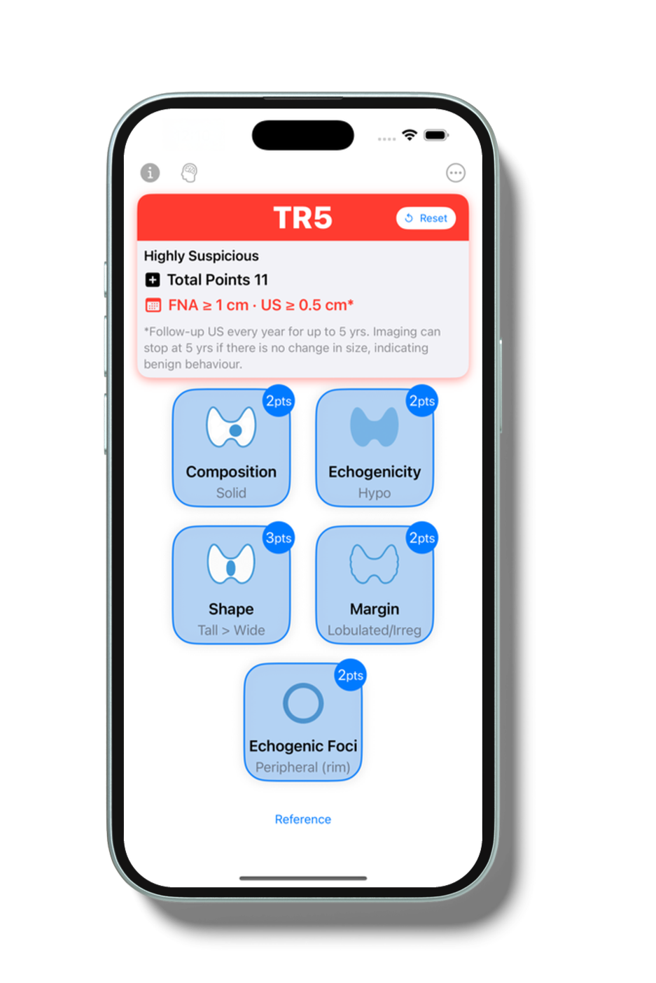 400x800bb-4_iphone_mockup.png
