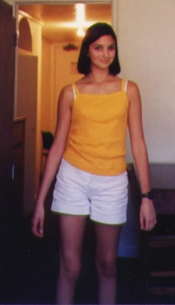 Lindsay, age 18. 25-degree lateral curve in lumbar spine. Take note of lifted right hip and dropped right shoulder.