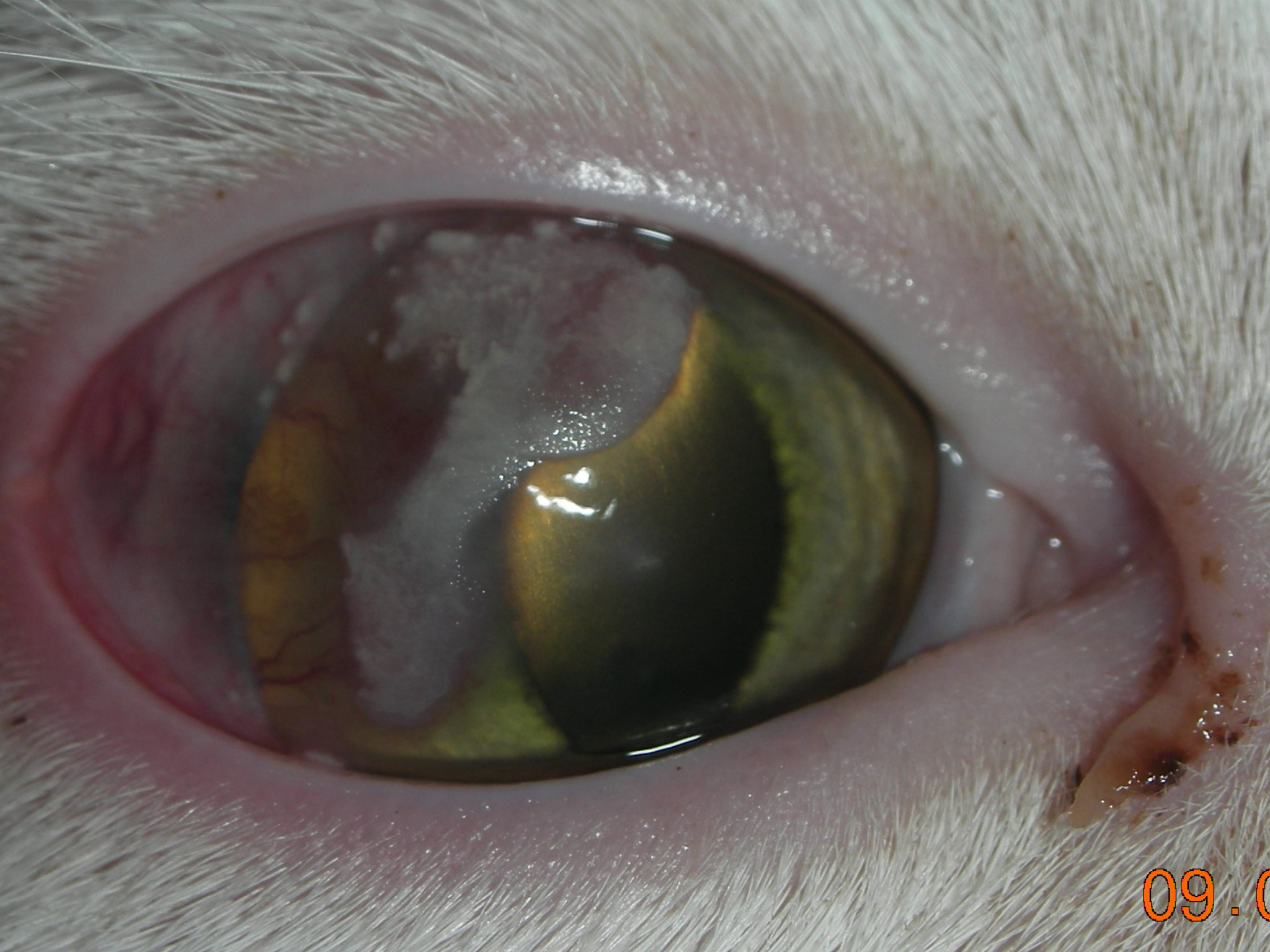 Eosinophilic Keratitis