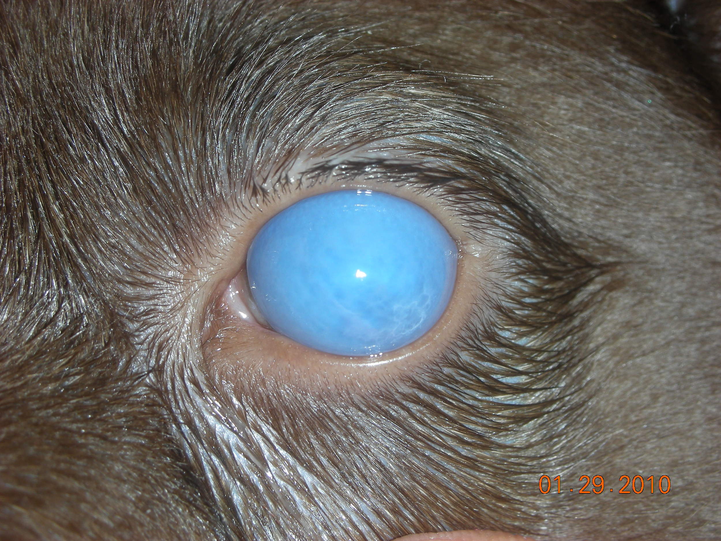 Vaccine Induced Uveitis