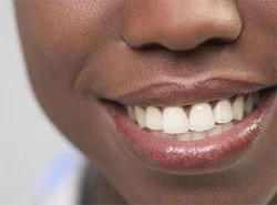 gum and teeth_C.F.-04.05.13.jpg