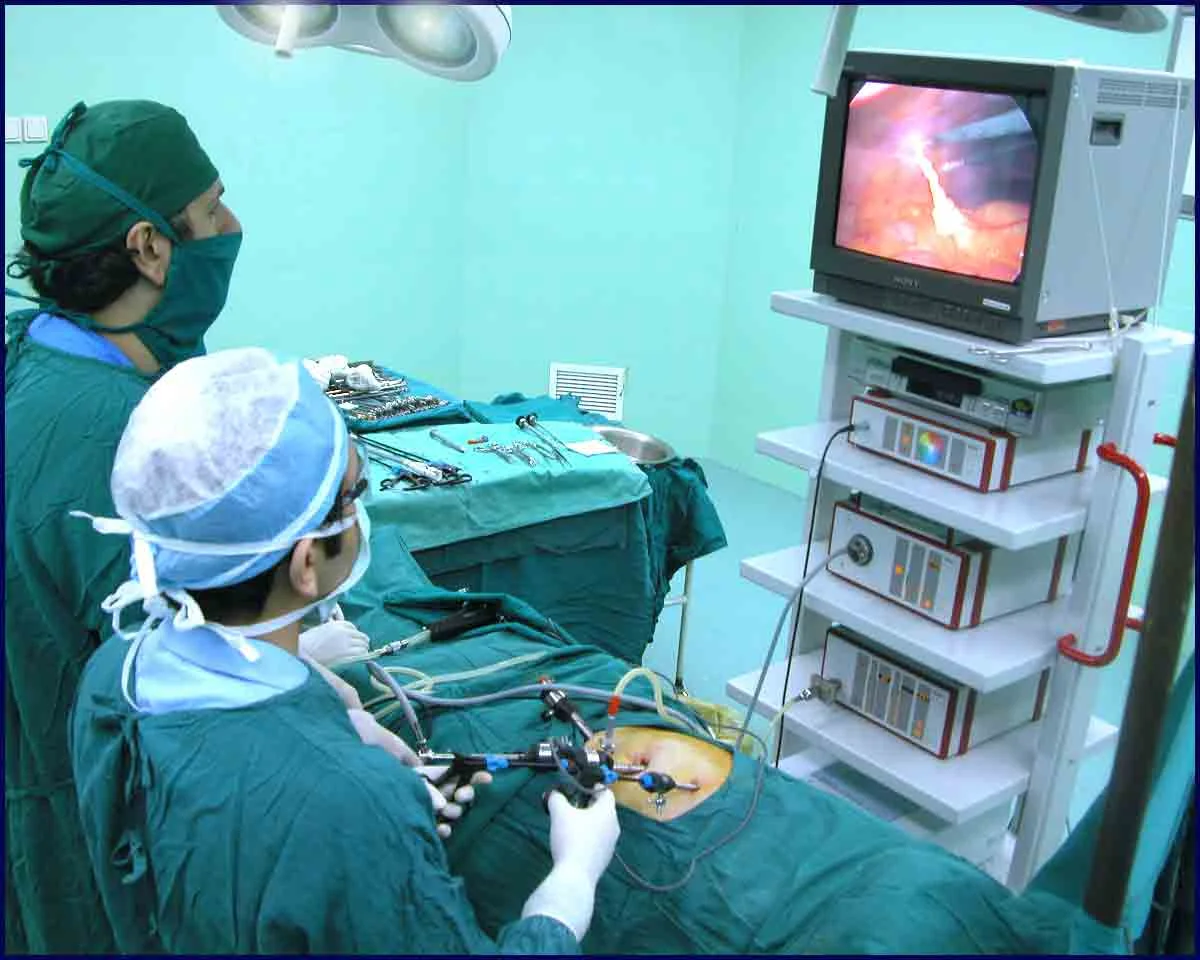 Laparoscopic Kidney Removal.jpg