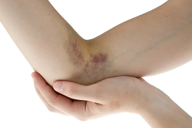 Download How Chronic Kidney Disease Patients Can Correct And Prevent Desktop Wallpaper Wallpaper How Chronic Kidney Disease Patients Can Correct And Prevent Free