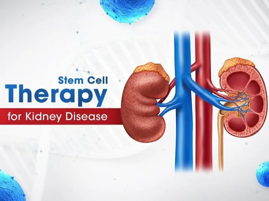 Kidney Transplant — KidneyBuzz