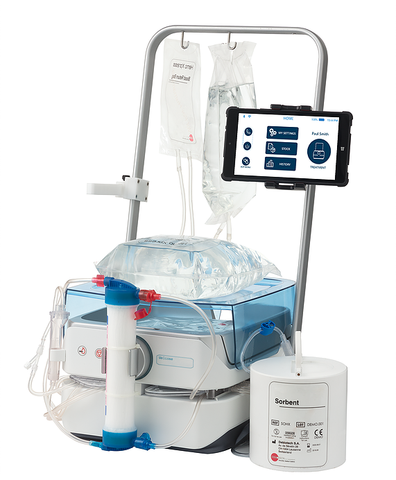 Dutch Based Company, NeoKidney, Commissioned To Make Portable Dialysis — KidneyBuzz