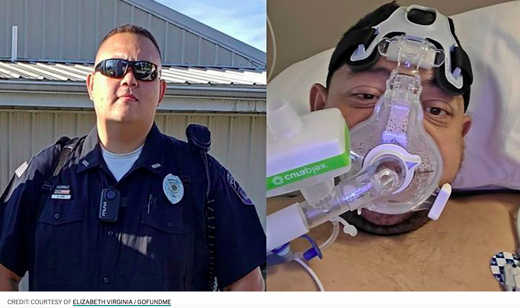 Best Breads For Chronic Kidney Disease and Dialysis Patients To Eat