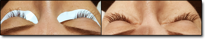 Before&After3.png