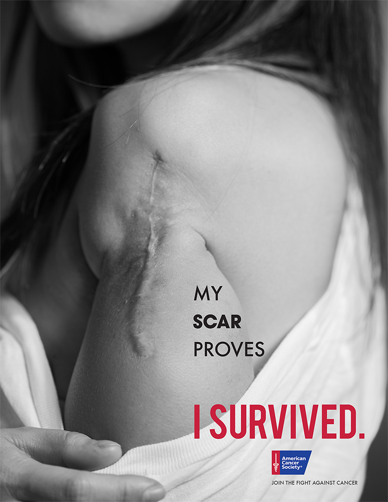 I Survived