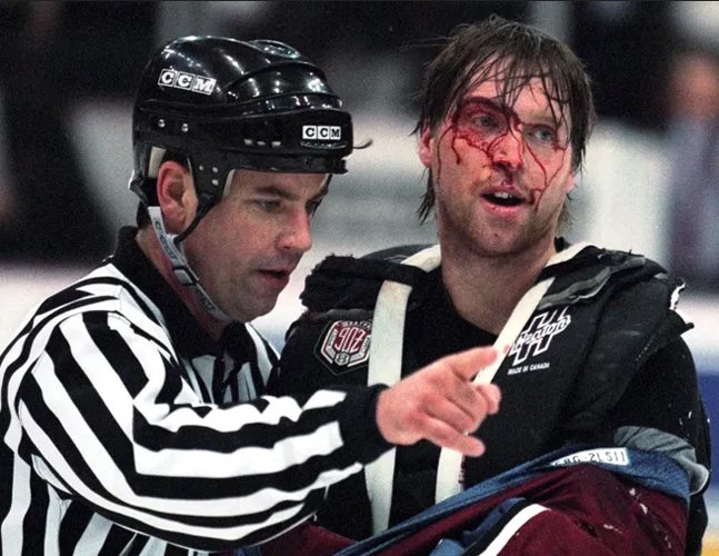 Bloody Patrick Roy after brawl with Mike Vernon