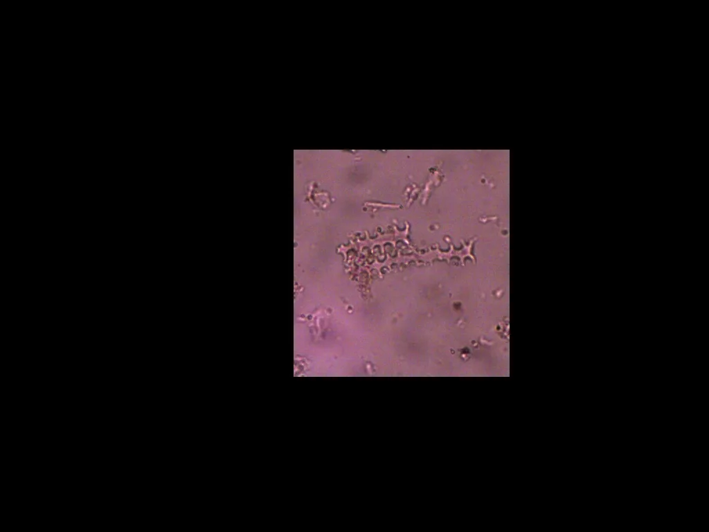long cell dendritic.jpg