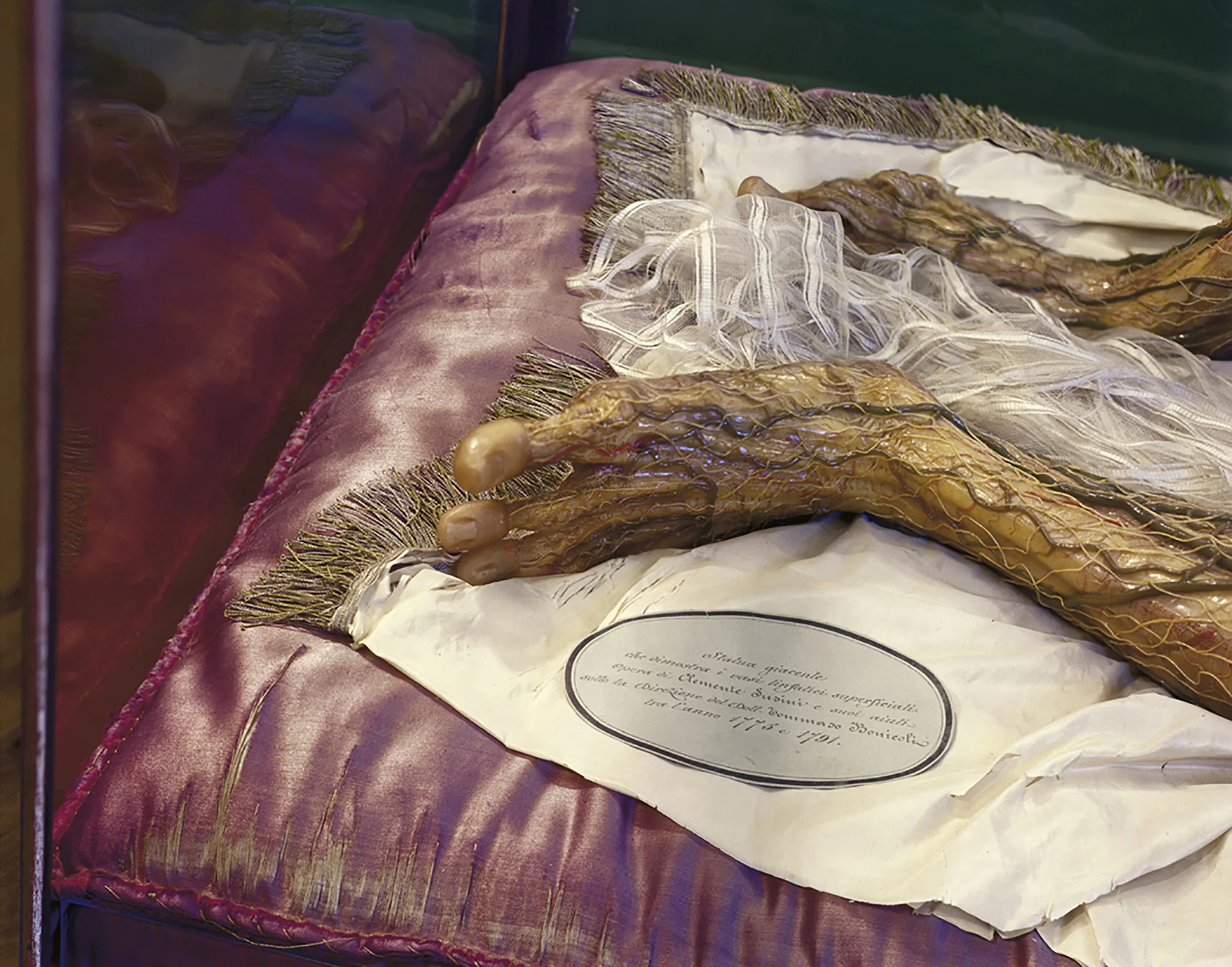 Wax Bodies Nº249, 2008 15 x 18" 