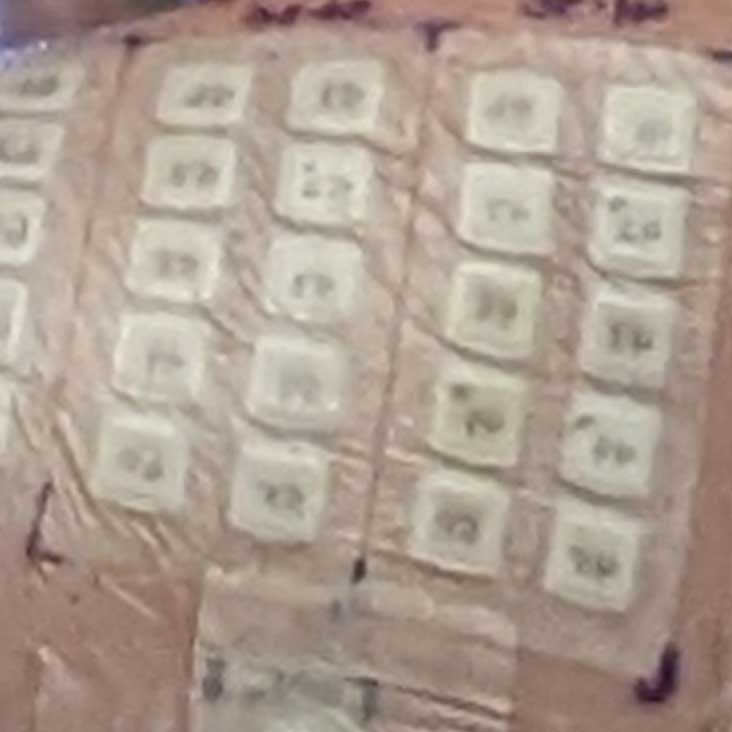 patch test - samples of various materials taped to back of a patient