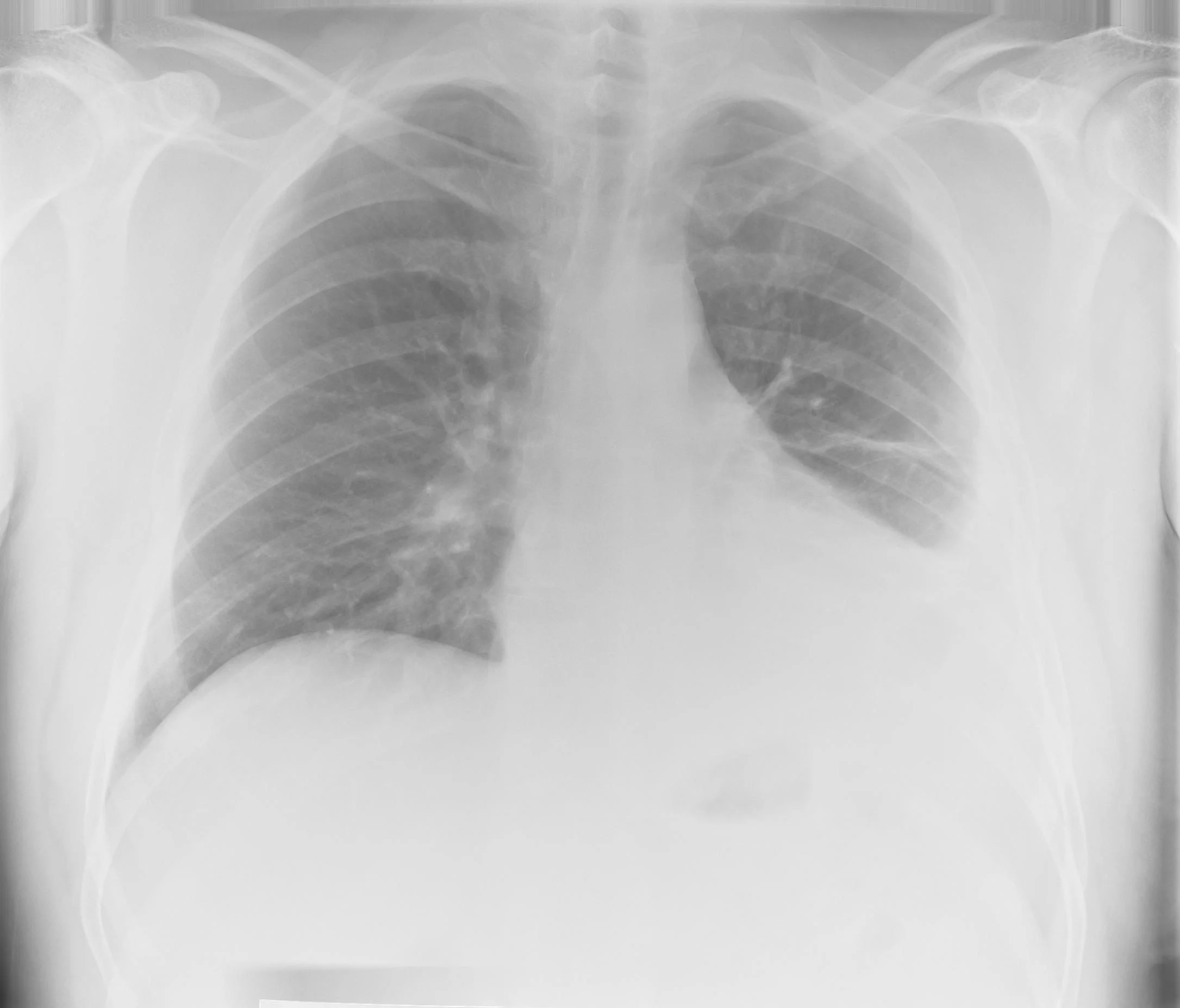 XRAYs — the simtech