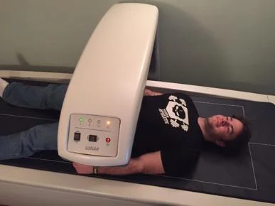 DEXA Scan