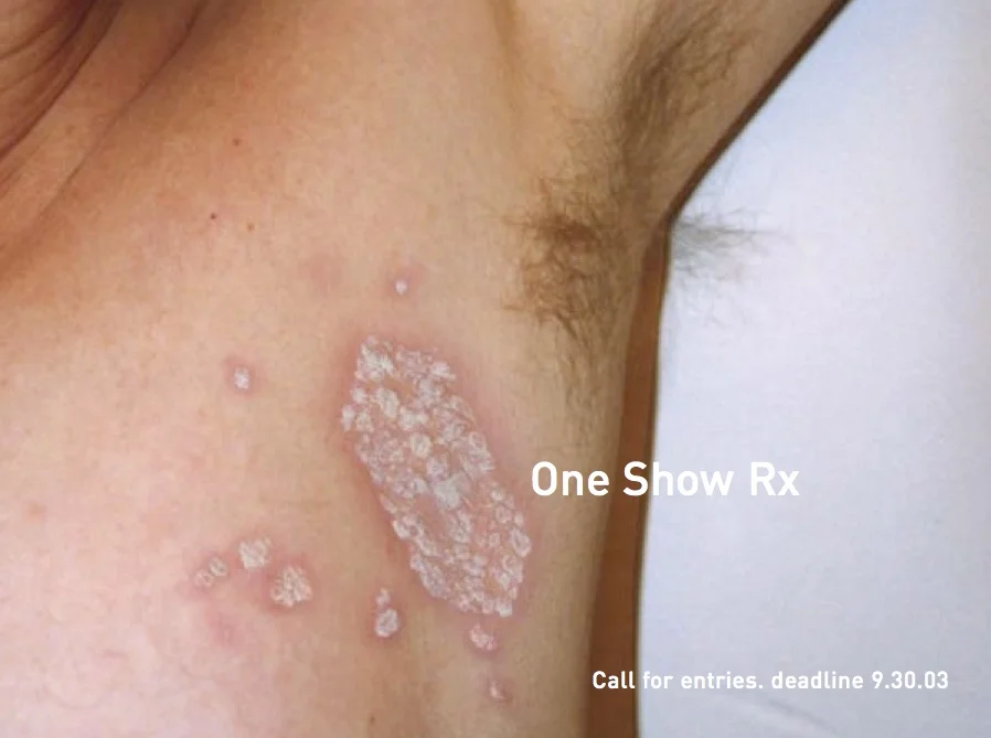 ONERX_2.jpg