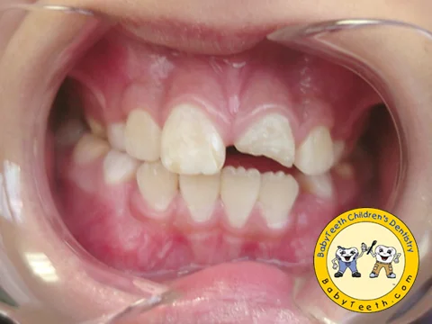 before_mouth.jpg