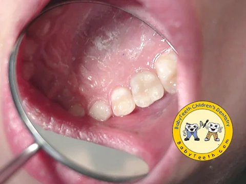 after_mouth.jpg