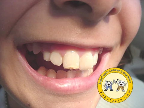 before_mouth.jpg
