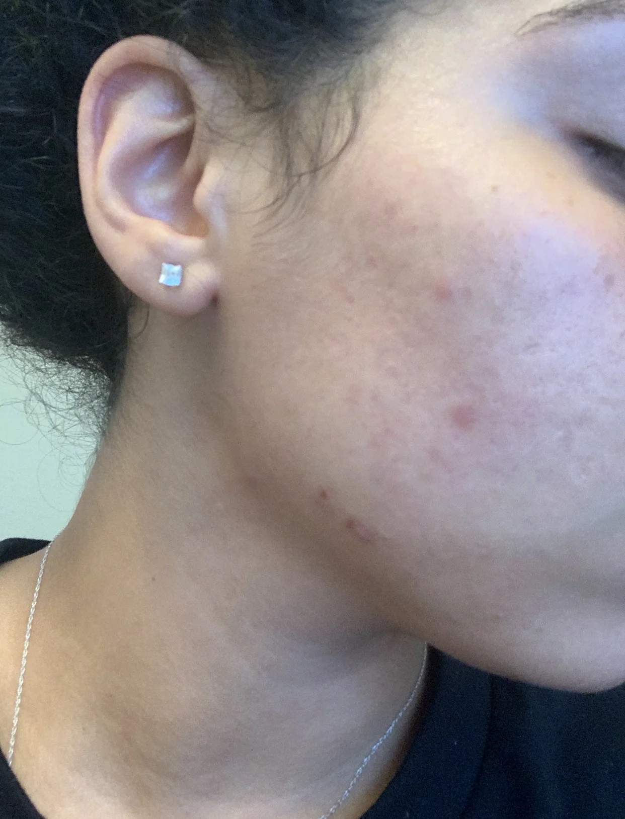 Before (July 15)
