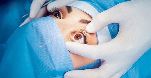 Lasik Eye Surgery Information