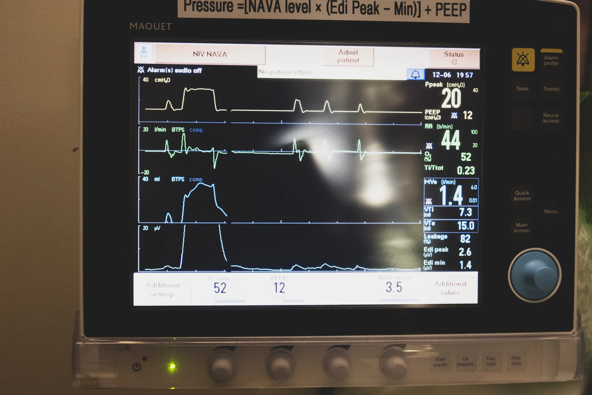 NICU Stay_198.jpg