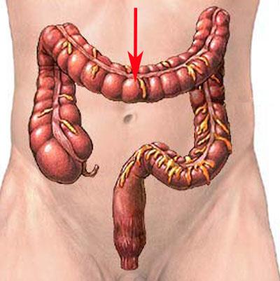Transverse Colon...
