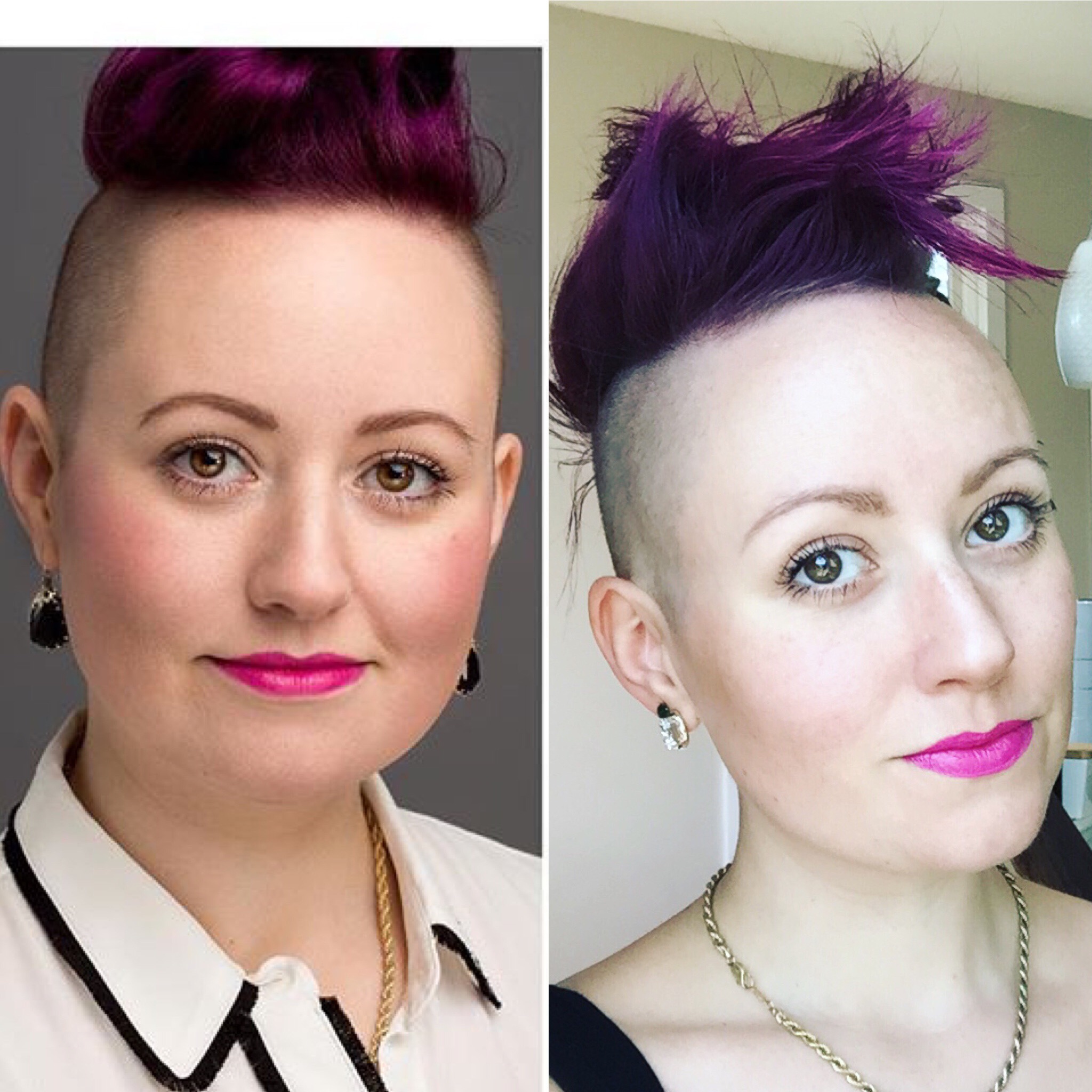 Face Progress About 90 Days In