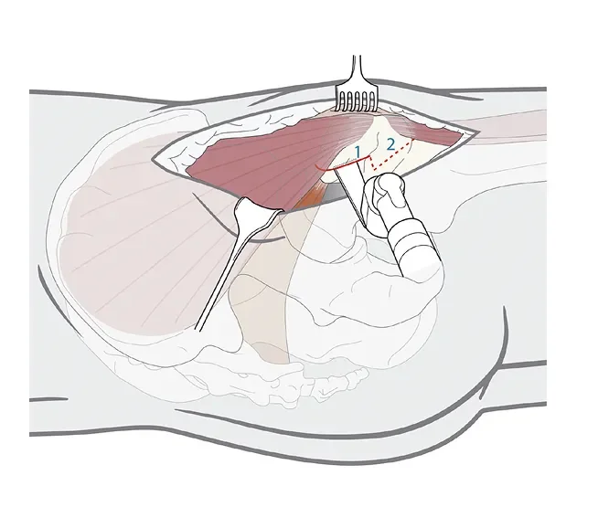 Screenshot 2025-03-31 at 11.36.07 1.webp