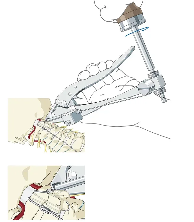 nougat_PF_Med_Ill_05_Page_14 1.webp